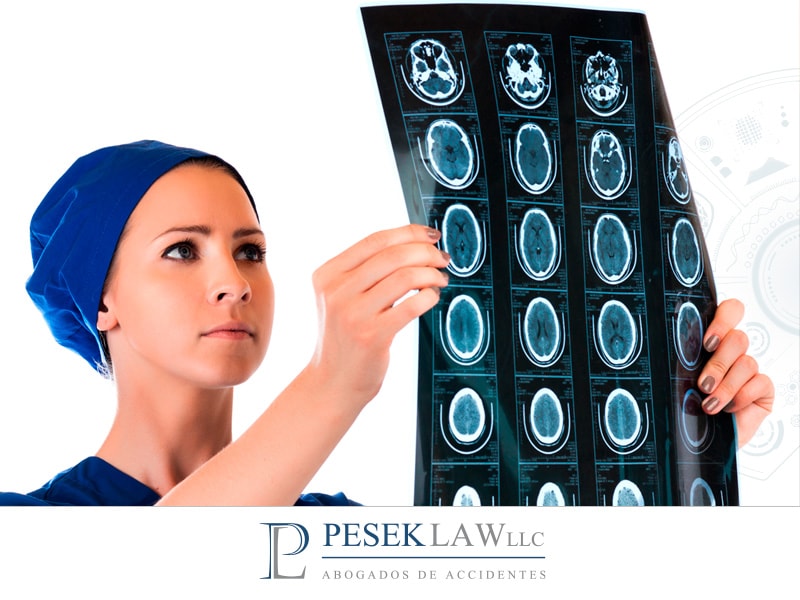 ¿CÓMO DETECTAR UNA LESIÓN CEREBRAL DESPUÉS DE HABER SUFRIDO UN ACCIDENTE?