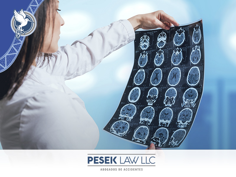 Pesek Law, protegiendo tus derechos: Identificación y Ayuda para Traumatismos Craneales