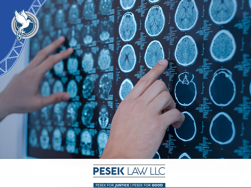 Lesiones Cerebrales: Impacto, Recuperación y Espera